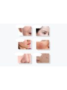 Ultrahangos arcmasszírozó fényterápiával ANLAN 01-ADRY15-001