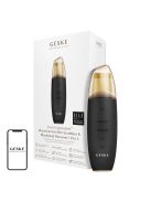 Geske 9 az 1-ben Okos ultrahangos bőrradír és mitesszer eltávolító fekete