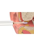 Smart Visual Ear-Clean Rod Bebird T15 fehér